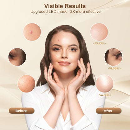 Red Light Therapy for Face, Led Face Mask Light Therapy with Rechargeable Remote, LED Face Mask Light Therapy at Home, Comfortable Red Light Therapy Mask