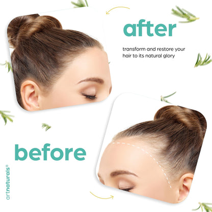 ArtNaturals Organic Rosemary & Castor Hair Growth Oil + Scalp Massager Set – Hair Relaxer for Dry, Itchy Scalp, Thickening & Hydration - Scalp Oil Products For Damaged Hair & Split Ends – 4.0 oz