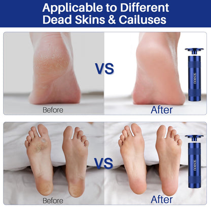 Electric Foot Callus Remover, 2-in-1 Electric Foot Filer/Nail Filer, Pedicure Kit Foot Scrubber Deadskin Callus Remover, Foot Care Kit Pedicure Tools for Dead Skin Dry Cracks- Blue