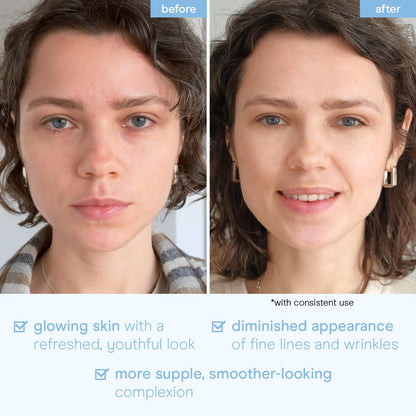 Baebody Snail Mucin Face Sheet Mask (6 pcs) - Anti Aging and Moisturizing Face Mask with Hyaluronic Acid - Deep Hydration for Youthful Skin