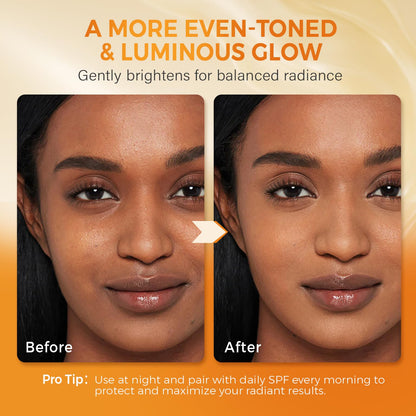 Turmeric Kojic Acid Soap for Dark Spots Brightening – Face and Body Wash with Vitamin C, Retinol, Collagen, Vitamin E, Glycerin, Shea Butter & Castile Olive Oil – Soap for Women & Men (120g x 2)