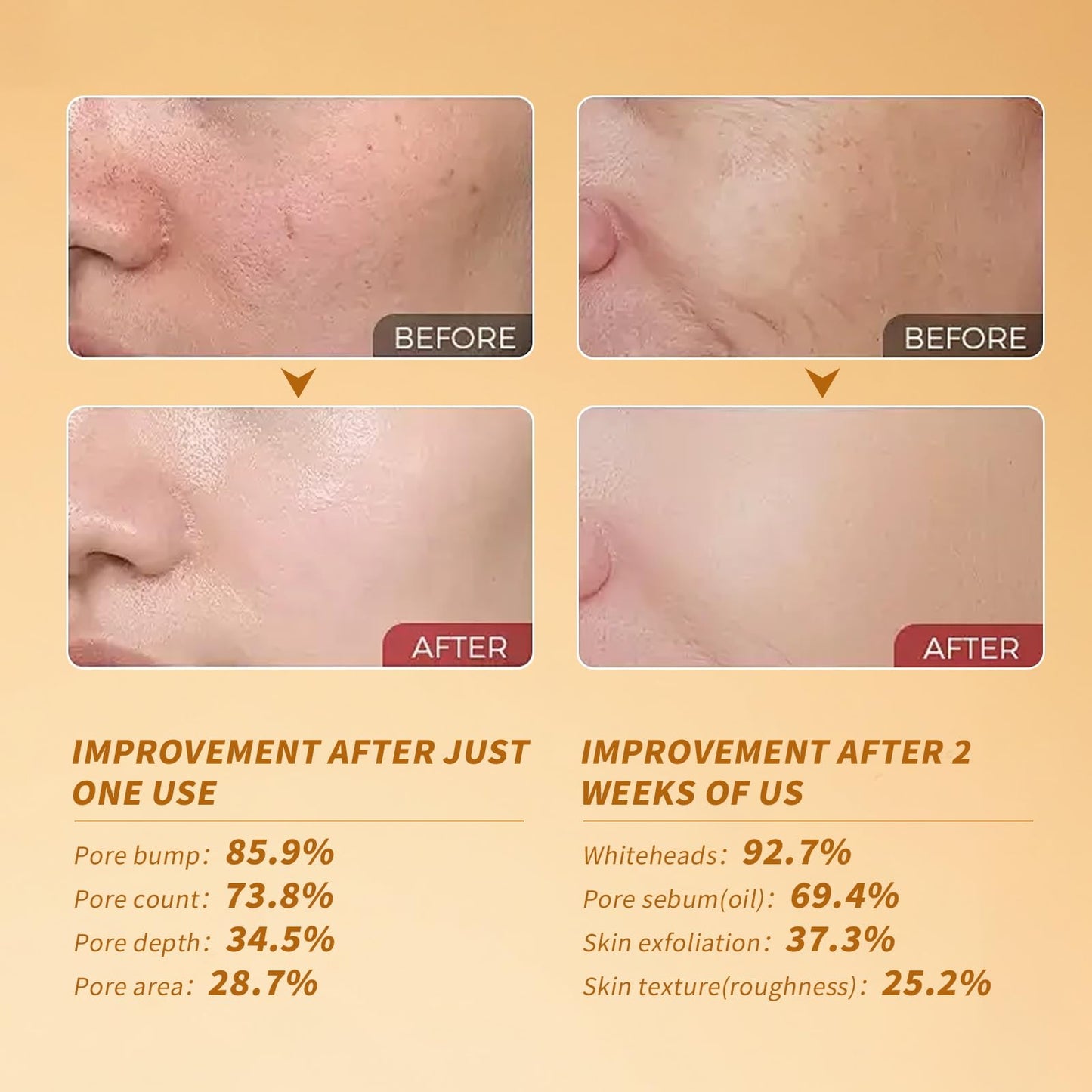 Black and White Rice Peeling, Soft Rice Exfoliating Face and Body, New glow rice Black and White Rice Exfoliant Duo Ampoule Set for All Skin Types, Gentle Peel & Deep Hydration 2 Pack (2.7 fl oz Each)