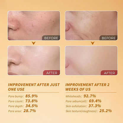 Black and White Rice Peeling, Soft Rice Exfoliating Face and Body, New glow rice Black and White Rice Exfoliant Duo Ampoule Set for All Skin Types, Gentle Peel & Deep Hydration 2 Pack (2.7 fl oz Each)