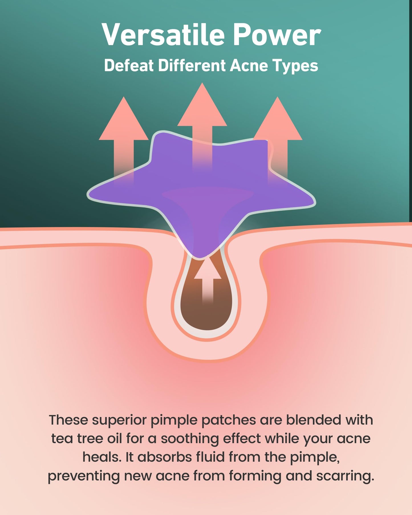 Acne Patches 112 Dots, Star Pimple Patches Hydrocolloid Acne Patches for Face Cute Zit Patches Pimple Stickers Acne Dots - Purple, Blue, Pink and Yellow