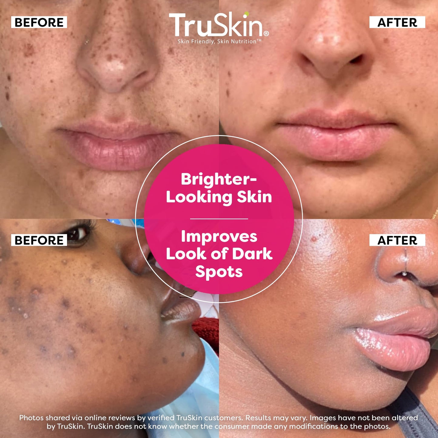 TruSkin Vitamin C Super Serum - Niacinamide, Retinol, Hyaluronic & Salicylic Acid - All-in-One Anti Aging Serum for Face – Improve Appearance of Dark Spots, Firmness for Brighter Looking Skin, 2 Fl Oz