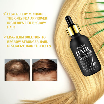 Minoxidil for Men & Women, Minoxidil for Women Hair Growth, Minoxidil for Men Beard, Natural Hair Regrowth Treatment for Hair Loss Hair Thinning, Thicker Fuller Healthier Hair