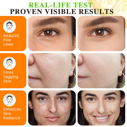 Vitamin C Serum For Face & Neck, Anti Aging & Wrinkle Facial Serum with Vitamin C, Ferulic Acid, Vitamin E, Boost Skin Collagen,Hydrate & Plump Skin, 60ml